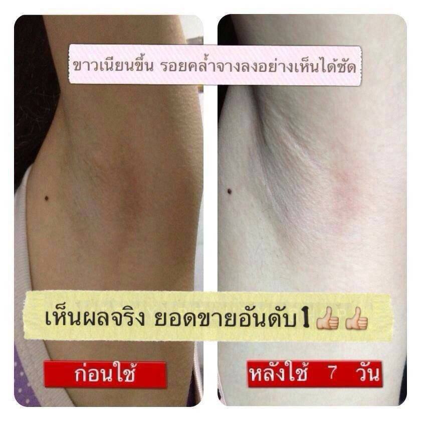 ลงประกาศฟรี ลงประกาศ  เพิ่มเว็บ  โฆษณาฟรี  ประกาศซื้อขายฟรีี  โปรโมทเว็บ ลงโฆษณาฟรี โปรโมทเว็บฟรี ประกาศซื้อขาย เพิ่มเว็บฟรี