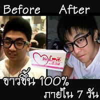ขาว สวย ภายใน 7 วัน