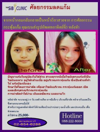 ลงประกาศฟรี ลงประกาศ  เพิ่มเว็บ  โฆษณาฟรี  ประกาศซื้อขายฟรีี  โปรโมทเว็บ ลงโฆษณาฟรี โปรโมทเว็บฟรี ประกาศซื้อขาย เพิ่มเว็บฟรี