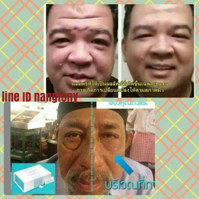 คูณถั่วแระ เปิดตัวสนค้าใสไทย